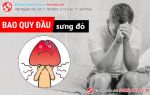 Đấng mày râu biết gì khi bao quy đầu đau rát, ngứa, tấy đỏ?