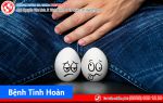 Các bệnh về tinh hoàn phổ biến thường gặp