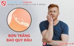 Bợn trắng bao quy đầu, tôi bị làm sao?