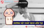 Chàng trai gánh hậu quả vì bỏ qua hiện tượng dương vật chảy dịch