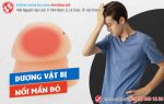 Nổi mẩn đỏ dương vật, nam thanh niên “ngã ngửa” khi nhận kết quả xét nghiệm