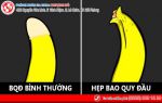 Hẹp bao quy đầu – ung thư gõ cửa chỉ vì sợ “mất bản lĩnh” đàn ông