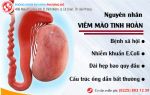 Viêm mào tinh hoàn có lượt tìm kiếm nhiều nhất