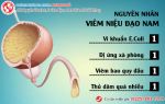 Có hay không viêm niệu đạo nam nguy hiểm?