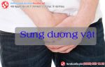Sưng dương vật là bị bệnh gì? Có chữa được không?