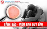 Viêm bao quy đầu ở nam: Nên thận trọng!