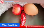 Cùng tìm hiểu bệnh viêm tinh hoàn