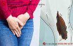 Âm đạo ra dịch màu nâu đen, màu đen có nguy hiểm không?
