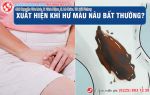 Chất nhầy màu nâu đen không ngờ lại nguy hiểm đến vậy