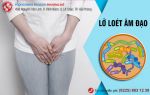 Lở loét âm đạo: Nguyên nhân và cách điều trị