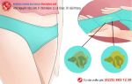 Âm đạo ra dịch màu vàng, dịch màu xanh là bệnh gì?