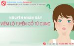 Nguyên nhân viêm lộ tuyến là gì? Có chữa được không?