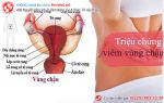 Nhận biết nhanh các dấu hiệu viêm vùng chậu nữ