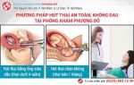 Phương pháp hút thai an toàn nhất hiện nay