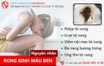 Rong kinh máu đen - Cẩn thận bệnh nguy hiểm