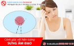 Cảnh giác với hiện tượng sưng âm đạo