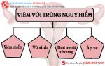 Điều trị viêm vòi trứng an toàn và hiệu quả