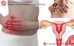 Triệu chứng viêm buồng trứng giúp nhận biết bệnh sớm