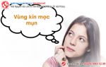 [Cảnh giác] – Vùng kín mọc mụn tưởng bình thường nhưng hóa ra