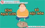 Hốt hoảng tìm gặp bác sĩ vì bị bệnh mạch lươn