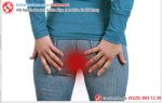 Tình Trạng Sưng Hậu Môn Cảnh Báo Điều Gì Từ Cơ Thể?