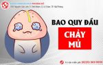 Bao quy đầu chảy mủ  - Cẩn thận bệnh lậu!