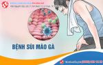 Thiếu kiến thức về bệnh sùi mào gà, gánh họa ung thư ở nhiều bộ phận