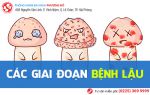 Tìm hiểu về các giai đoạn của bệnh lậu
