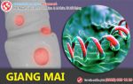 Giang mai ở nam – sát thủ thầm lặng