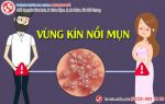 Bỗng dưng vùng kín nổi mụn rộp sinh dục