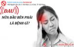 Có dấu hiệu đau nửa đầu bên phải là bệnh gì?