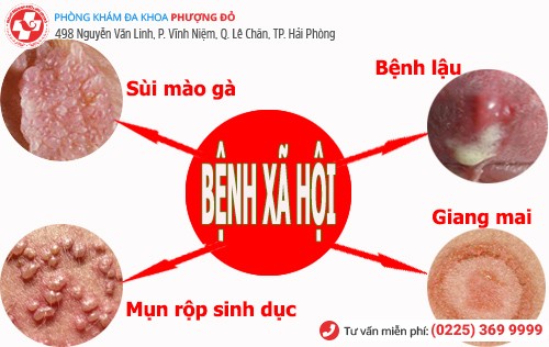 bệnh xã hội