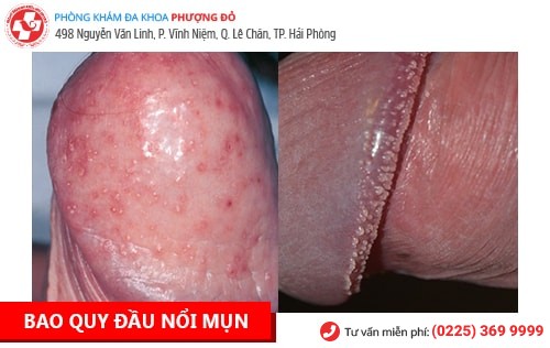 Địa chỉ phòng khám nam khoa Hạ Long uy tín