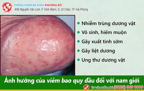 Hình ảnh viêm quy đầu chân thực nhất