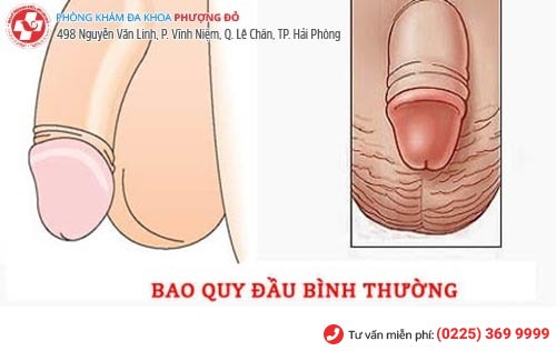 Hình ảnh bao quy đầu bình thường