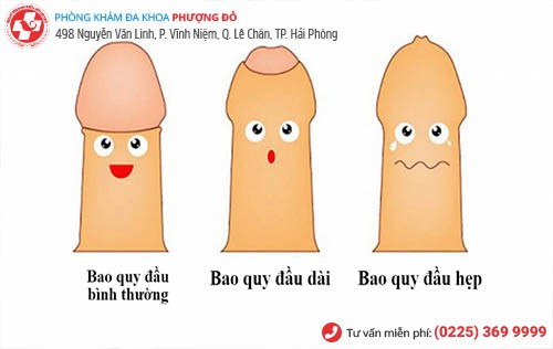 bao quy đầu dài và hẹp