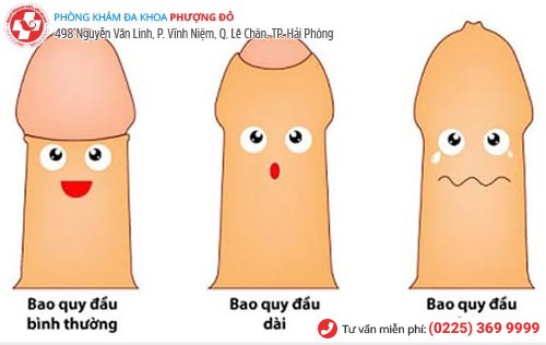 Các bệnh vùng kín ở nam giới không nên bỏ qua