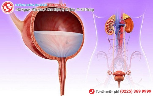 Hình ảnh đường tiết niệu bị viêm