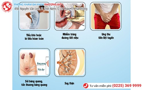 Nguy hiểm khi đau tuyến tiền liệt chuyển sang mức độ nặng