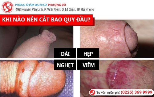 [GIẢI ĐÁP THẮC MẮC]: Tại sao phải cắt bao quy đầu?