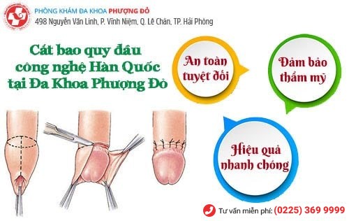 Cắt bao quy đầu công nghệ Hàn Quốc