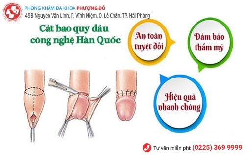 Phương pháp tiểu phẫu cắt bao quy đầu công nghệ xâm lấn tối thiểu Hàn Quốc