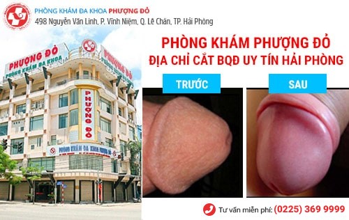 Cắt bao quy đầu mất bao nhiêu tiền? Giải đáp chi tiết từ bác sĩ chuyên khoa