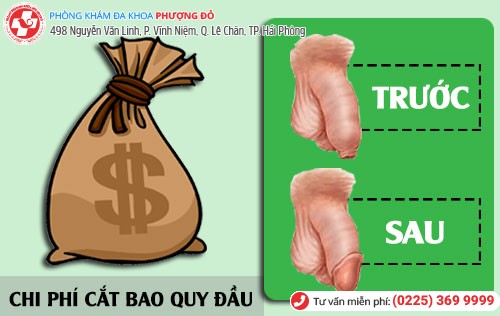 Chi phí cắt bao quy đầu