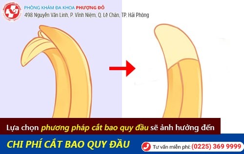 Chi phí cắt bao quy đầu ở Hải Phòng bao nhiêu tiền?