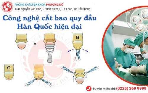 Phương pháp cắt bao quy đầu công nghệ xâm lấn tối thiểu Hàn Quốc