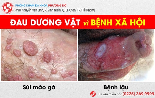 đau dương vật do bệnh lý