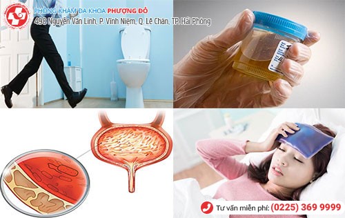 1 số dấu hiệu nhiễm trùng đường tiểu cần lưu ý