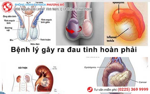 Nhiều bệnh liên quan đến tình trạng đau tinh hoàn phải