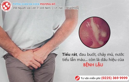 Đi tiểu bị rát vùng kín do bệnh gì gây nên?